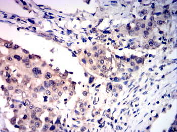 EGR1 Antibody