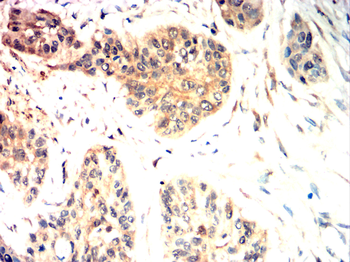 FAP Antibody