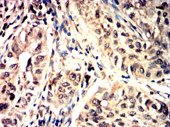 FAP Antibody