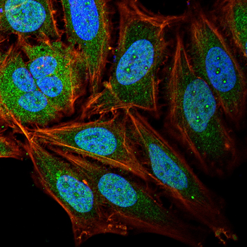 CREBBP Antibody