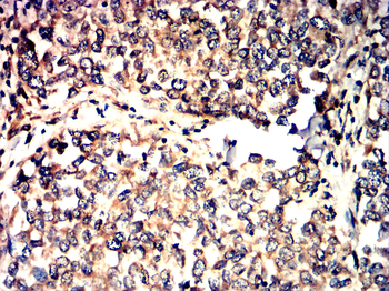 CREBBP Antibody