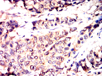 CREBBP Antibody