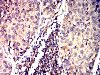 CREBBP Antibody