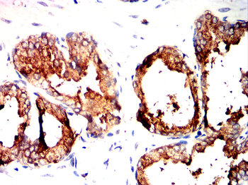 CREBBP Antibody