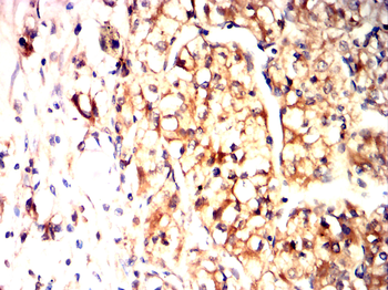 CREBBP Antibody