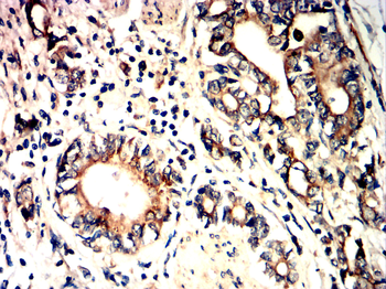 CREBBP Antibody