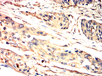 SMAD6 Antibody