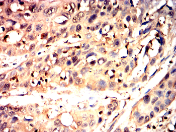 SMAD6 Antibody