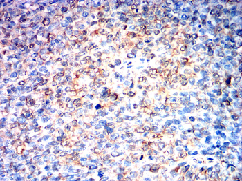 SMAD6 Antibody
