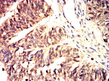 SMAD6 Antibody
