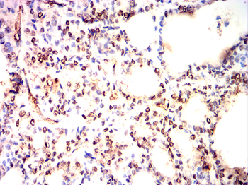 SMAD6 Antibody