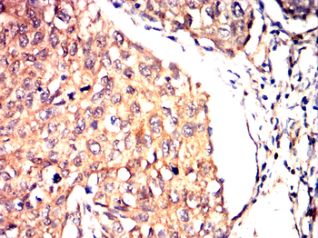 SIRT2 Antibody
