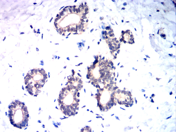 NOTCH2 Antibody
