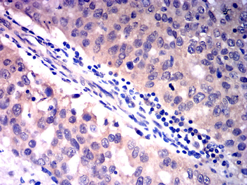 NOTCH2 Antibody