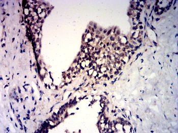 NOTCH2 Antibody