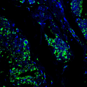 CANX Antibody