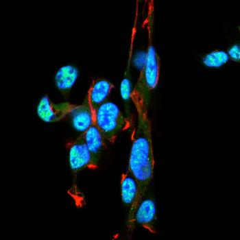 DNMT3B Antibody