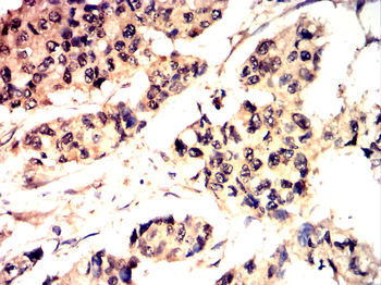 DNMT3B Antibody