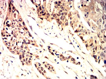 DNMT3B Antibody