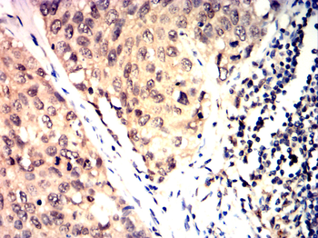 DNMT3B Antibody