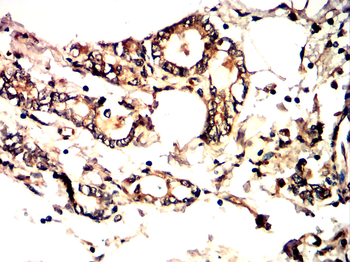 DNMT3B Antibody