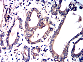 HSPB1 Antibody