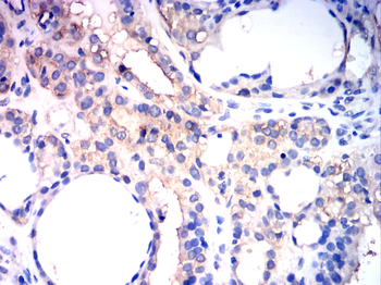 HSPB1 Antibody