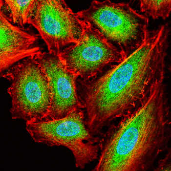 HSPB1 Antibody