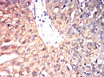 HSPB1 Antibody