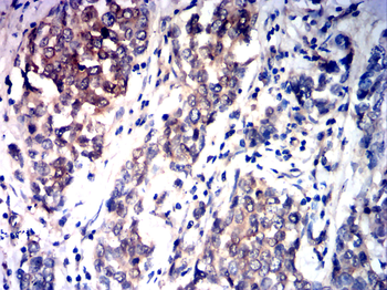 HSPB1 Antibody