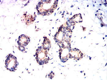 HSPB1 Antibody