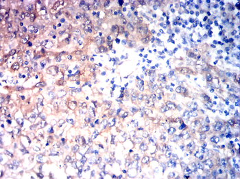 HSPB1 Antibody