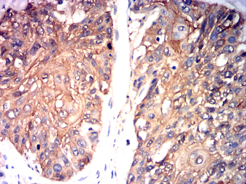 HSPB1 Antibody