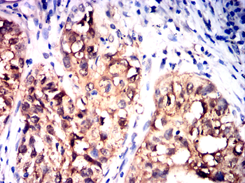 HSPB1 Antibody