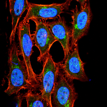 PGR Antibody