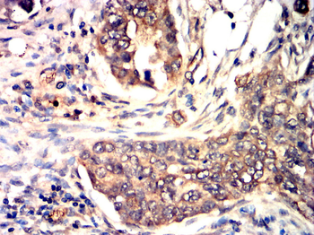 PGR Antibody
