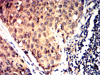 PGR Antibody