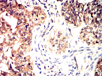 PGR Antibody