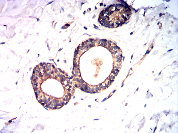 PDGFRB Antibody