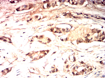FGFR1 Antibody