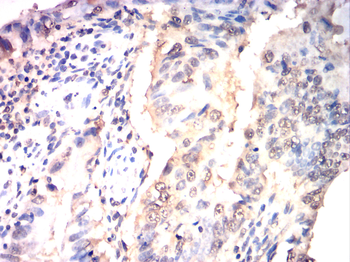 FGFR1 Antibody