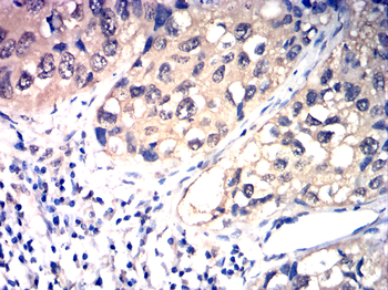 FGFR1 Antibody