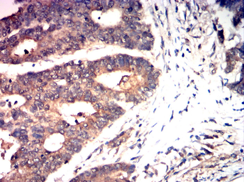 FGFR1 Antibody