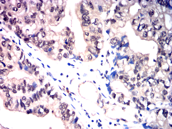 PRKCA Antibody