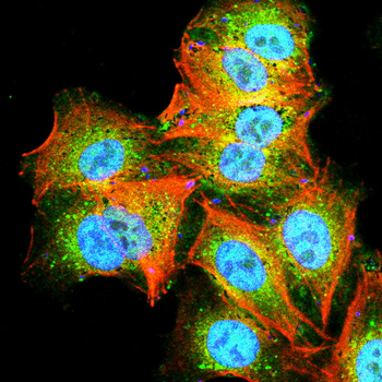 PRKCA Antibody