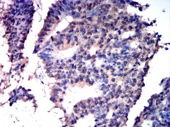 PRKCA Antibody