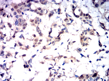 PRKCA Antibody