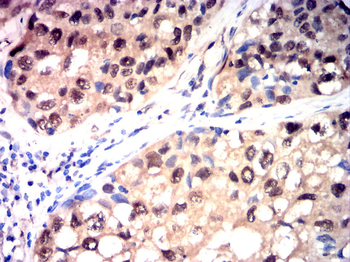 PRKCA Antibody