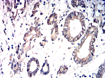 PRKCA Antibody