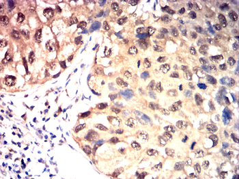 PTPN6 Antibody